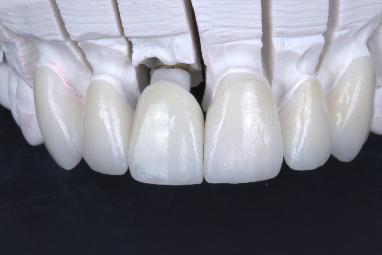 Porcelain work on the model, before delivery